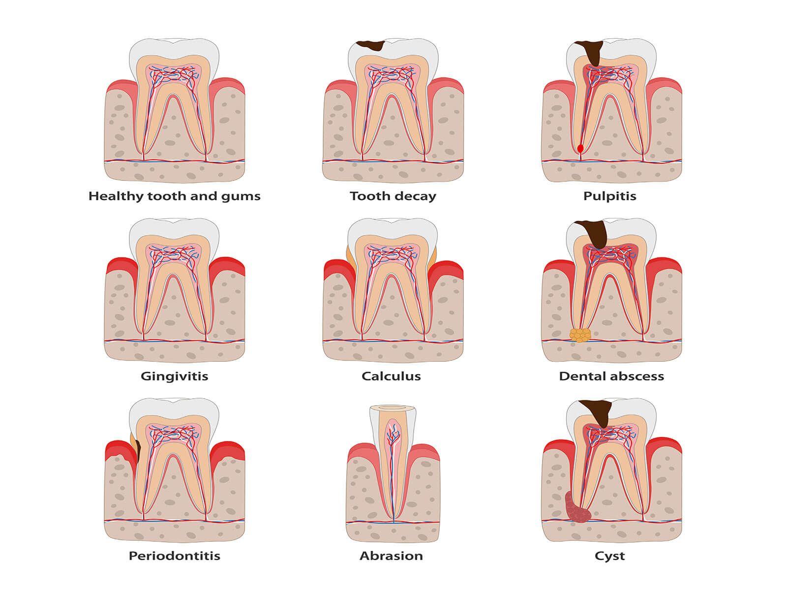 Thooth Problem 15 Common Dental Problems & Tooth Diseases You Should Know About